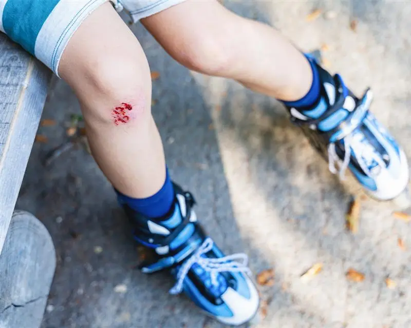 healthy-vs-infected-wound